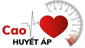 Những lưu ý khi sơ cứu cho người cao huyết áp